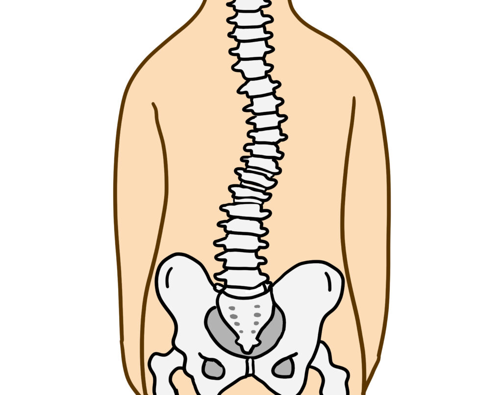 背骨の側弯は原因を見つければ怖くない！